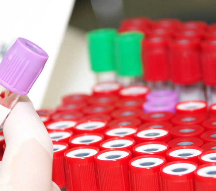 image18-p5nmhc9e4w2151e990w50s5itovgzrgsgysv9f1z12